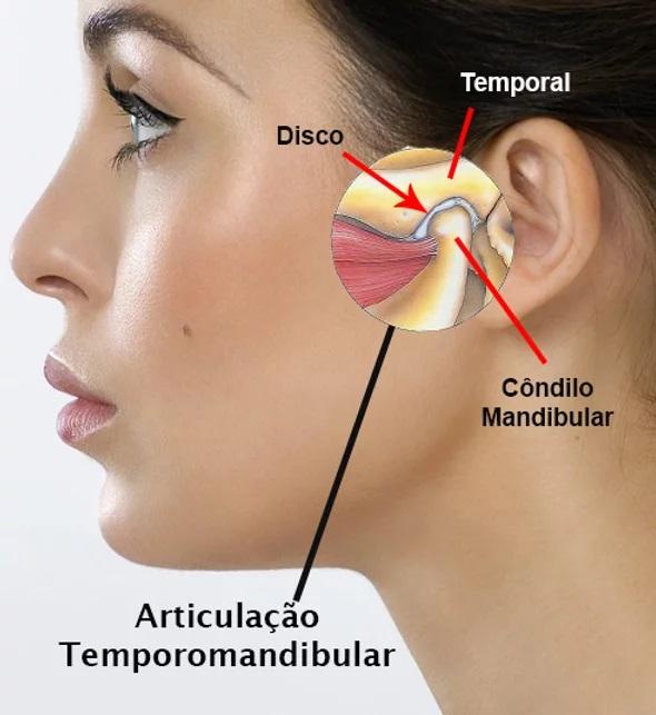 Disfunção Temporomandibular (DTM)